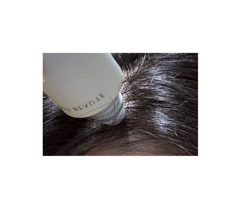 スカルプマッサージヘアエッセンス/綺和美/頭皮ローションを使ったクチコミ（3枚目）