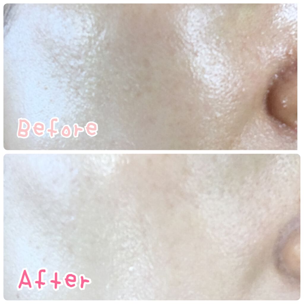 ã¢ãªã£ãŒ ã¯ãããã¥ãŒã㣠ã«ã©ãŒãã¥ãŒãã³ã°UV/ã¢ãªã£ãŒ/æ¥çŒãæ¢ãã¯ãªãŒã ã䜿ã£ãã¯ãã³ãïŒ3æç®ïŒ