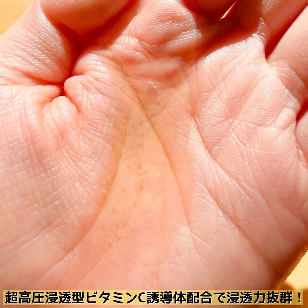 V エッセンス/unlabel/美容液を使ったクチコミ（3枚目）