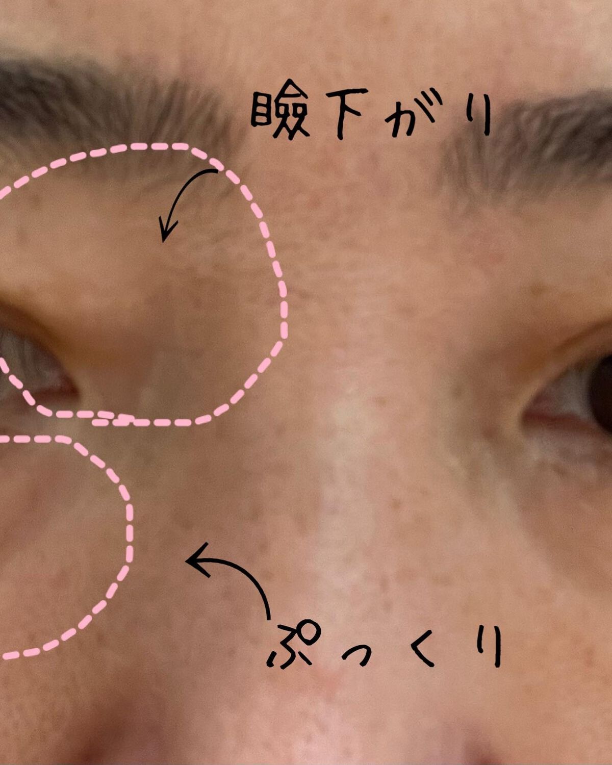 リッドキララ/北の快適工房/アイケア・アイクリームを使ったクチコミ（2枚目）