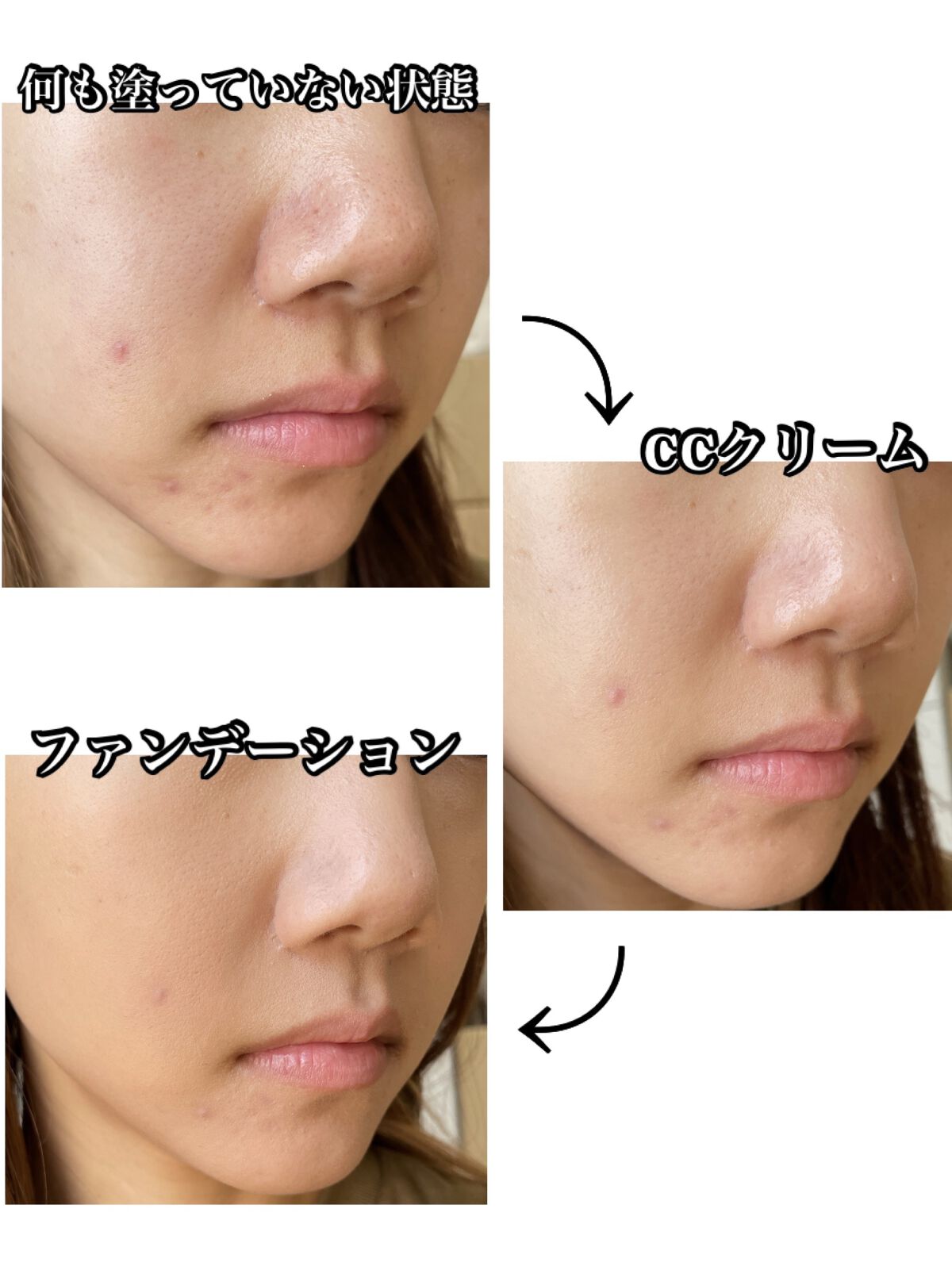 薬用 スキンケアファンデーション（パウダリー）/d プログラム/パウダーファンデーションを使ったクチコミ（3枚目）