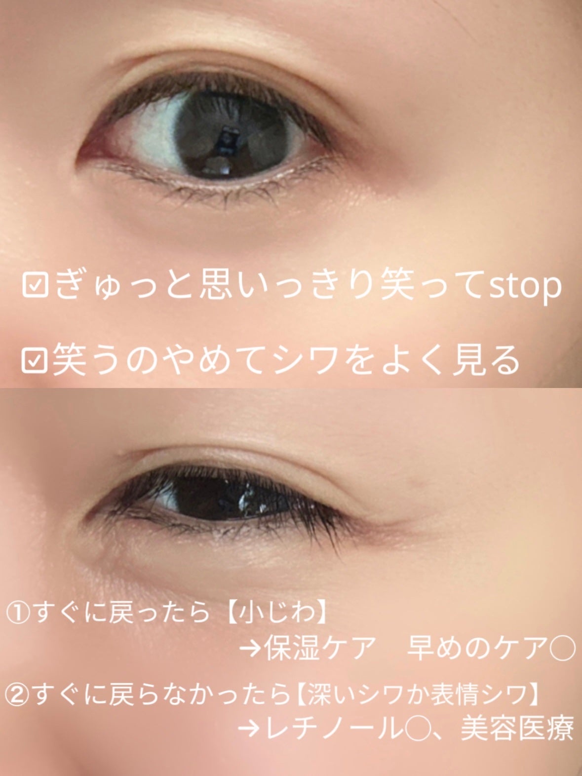 リンクルボールセラム/ライスフォース/美容液を使ったクチコミ(2枚目)