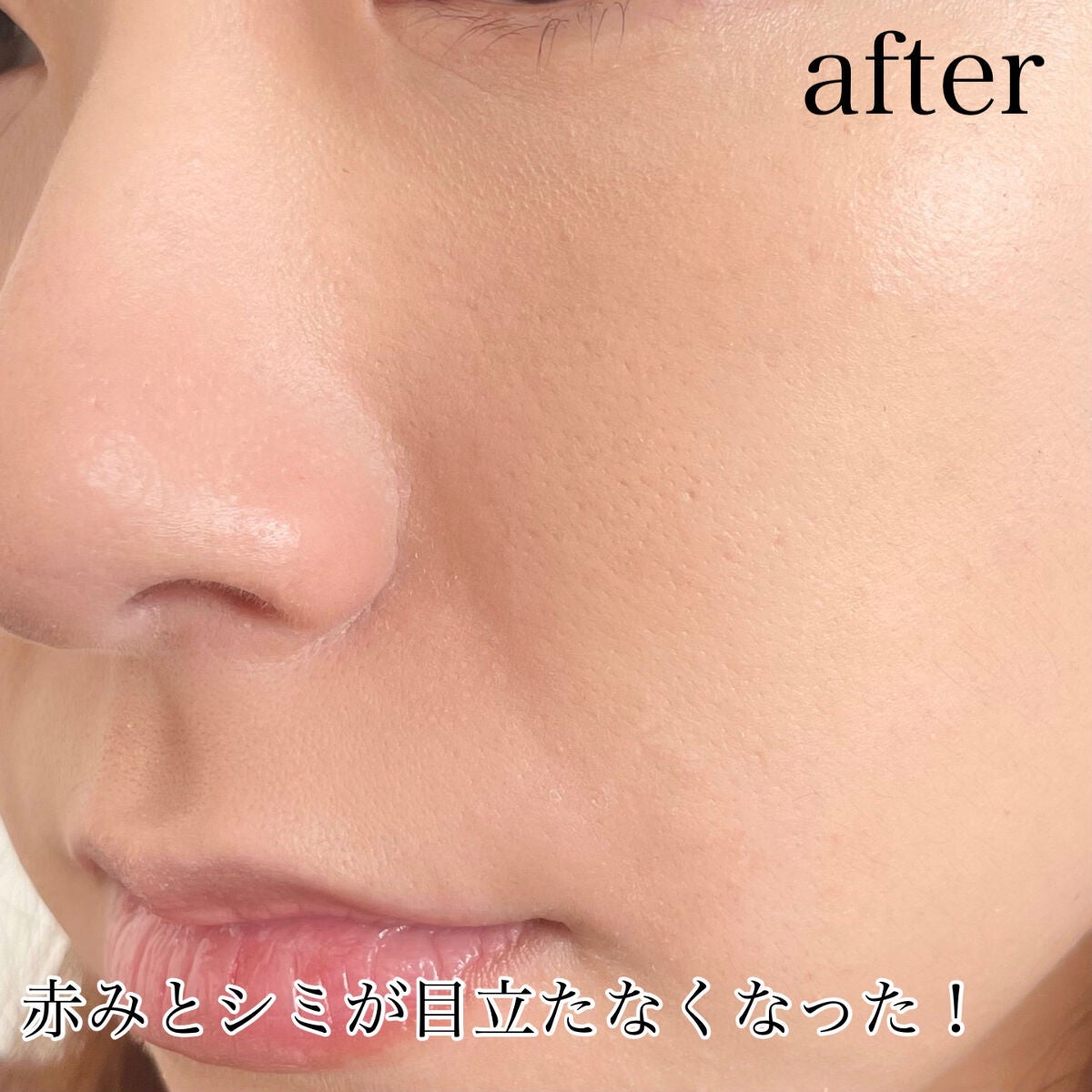 ルミナスフィット クッションファンデーション /ODELIA/クッションファンデーションを使ったクチコミ(5枚目)