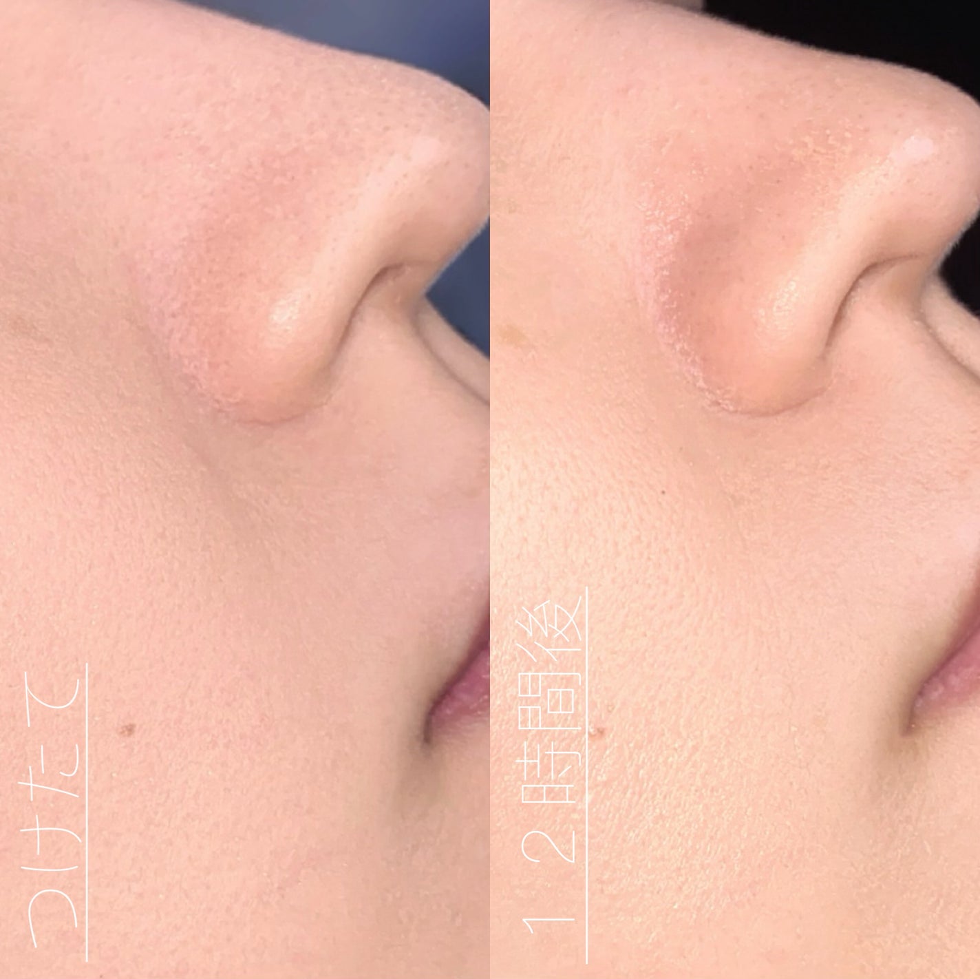 SPステイ ルミマット リキッド ファンデーション/MAYBELLINE NEW YORK/リキッドファンデーションを使ったクチコミ(10枚目)