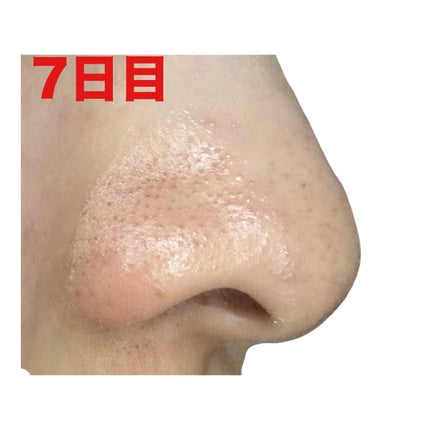 ディープクリア酵素洗顔 /メラノCC/洗顔フォームを使ったクチコミ(10枚目)