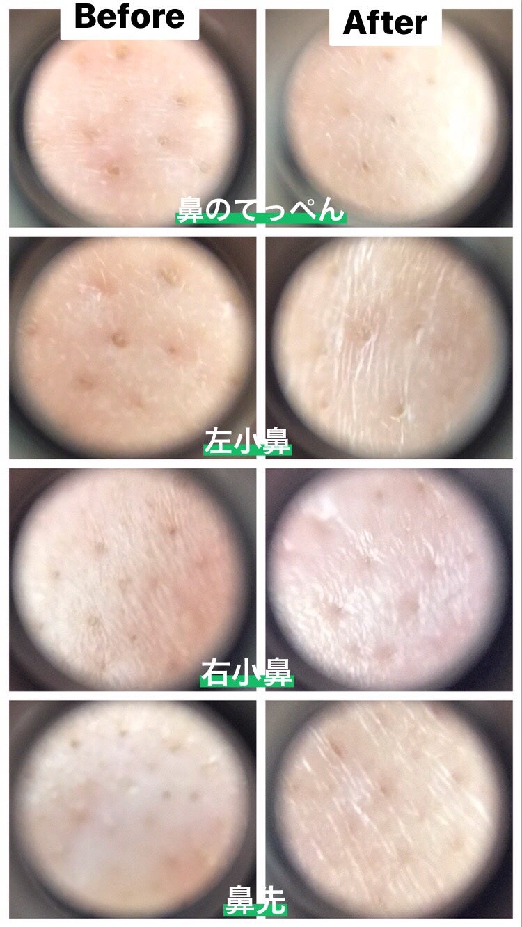 シカレチA エッセンス0.1/VT/美容液を使ったクチコミ(2枚目)