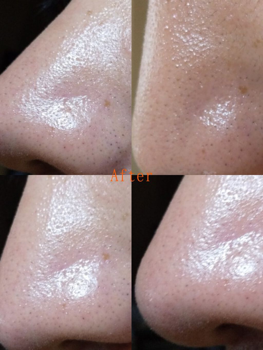 シラクル ビューティシート/Ciracle/トナーパッドを使ったクチコミ（3枚目）