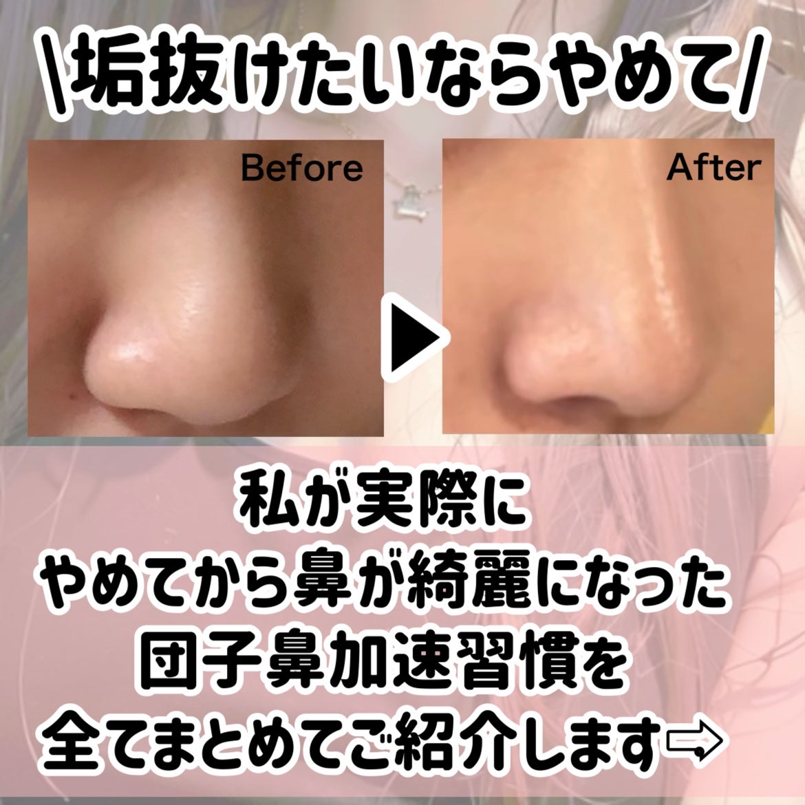 ハトムギ保湿ジェル(ナチュリエ スキンコンディショニングジェル)/ナチュリエ/美容液を使ったクチコミ(2枚目)