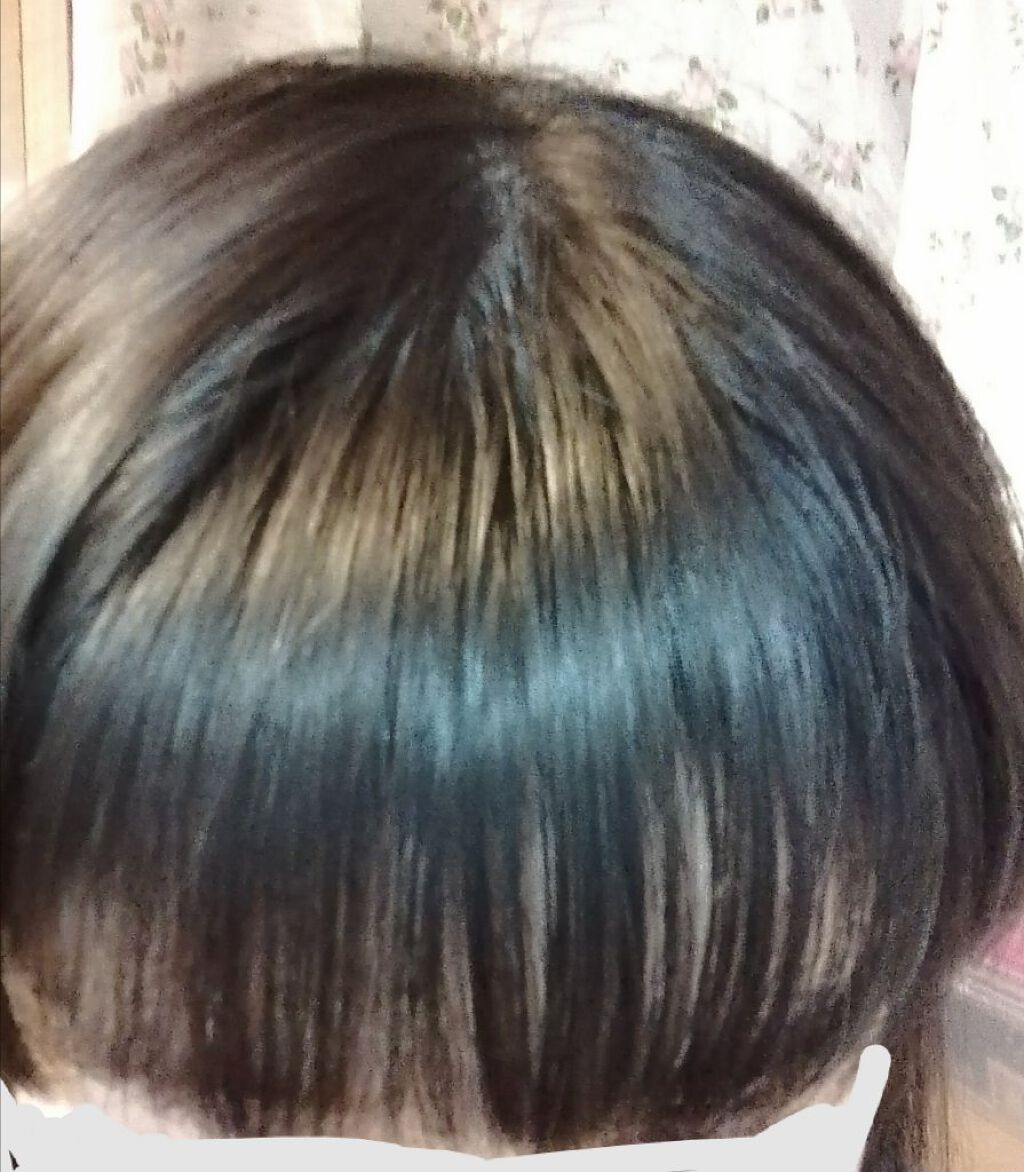 ハトムギ化粧水(ナチュリエ スキンコンディショナー R )/ナチュリエ/化粧水を使ったクチコミ(1枚目)