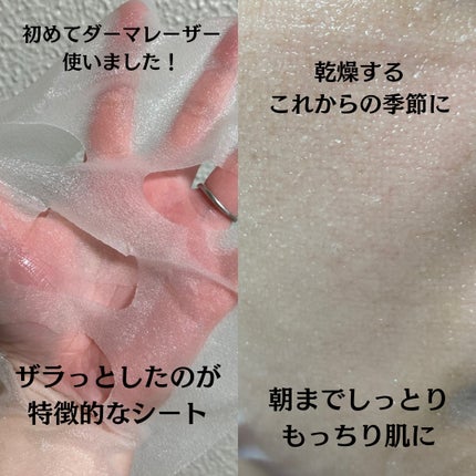 ダーマレーザー スーパーセラミド100マスク/クオリティファースト/シートマスク・パックを使ったクチコミ(3枚目)