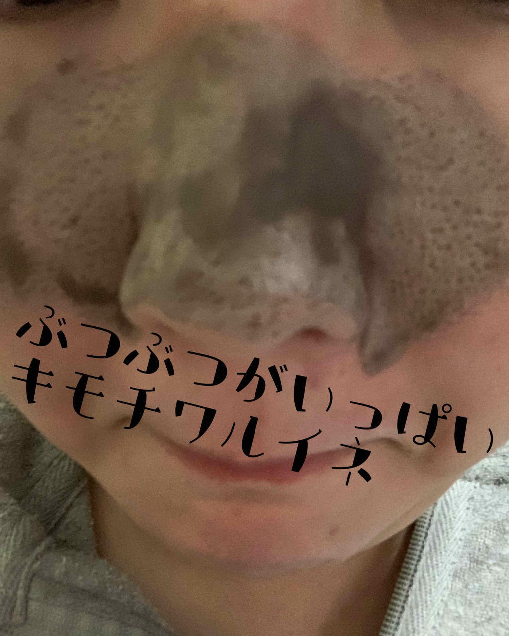 ツルリ 皮脂吸い出し 部分用パック ガスール＆レッドパワー/ツルリ/洗い流すパック・マスクを使ったクチコミ（1枚目）