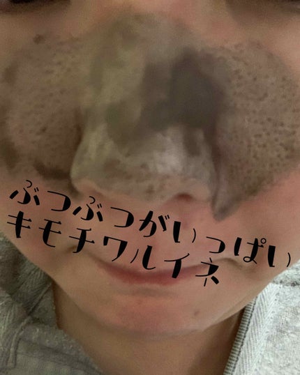 ツルリ 皮脂吸い出し 部分用パック ガスール&レッドパワー/ツルリ/洗い流すパック・マスクを使ったクチコミ(1枚目)