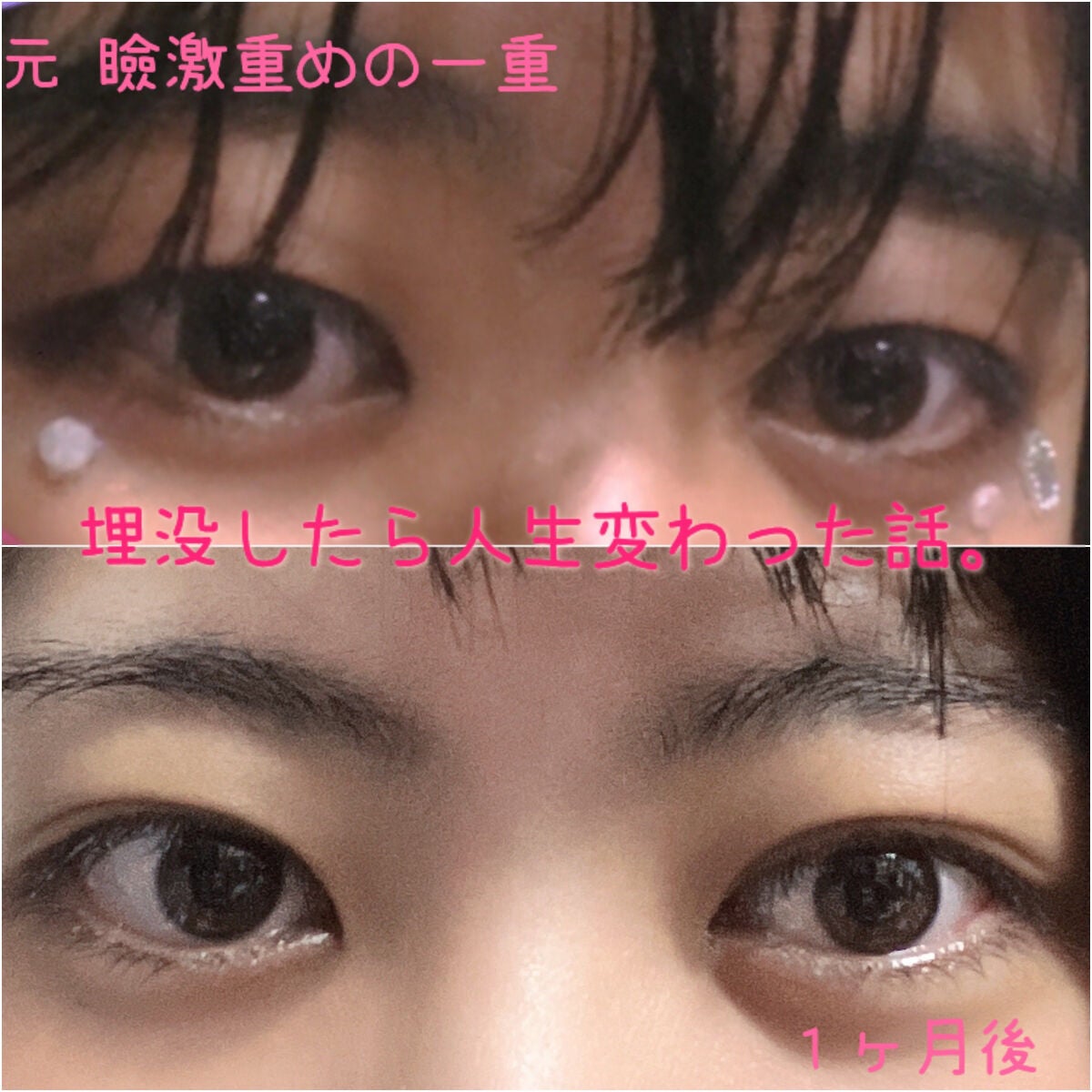 ワンダーアイリッドテープ Extra/D-UP/二重まぶた用アイテムを使ったクチコミ(1枚目)