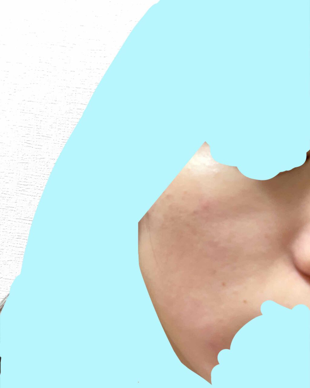 ヒルメナイド油性クリーム（医薬品）/matsukiyo/その他を使ったクチコミ（2枚目）