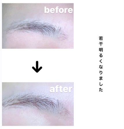 脱色クリーム スピーディー/エピラット/ムダ毛ケアを使ったクチコミ(6枚目)