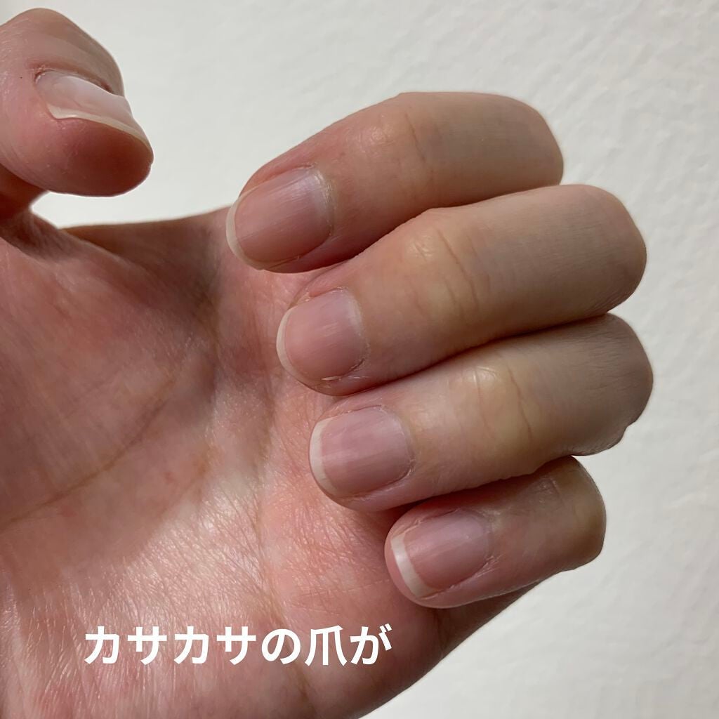 薬用 クリアストロングショット アルファ/北の快適工房/レッグ・フットケアを使ったクチコミ(4枚目)