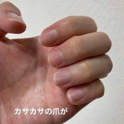 薬用 クリアストロングショット アルファ/北の快適工房/レッグ・フットケアを使ったクチコミ(4枚目)