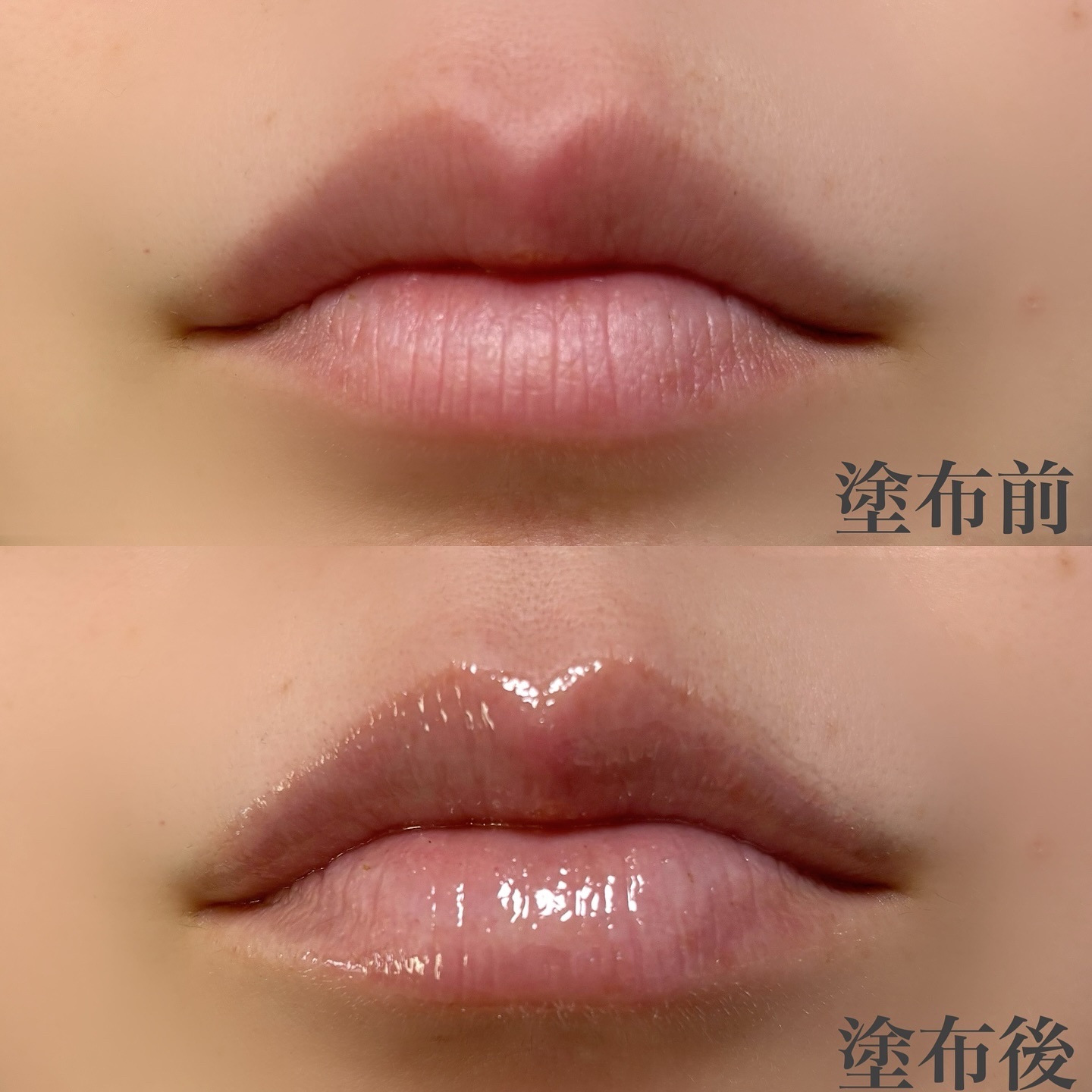 エスト ザ リップセラム/est/リップ美容液を使ったクチコミ（2枚目）