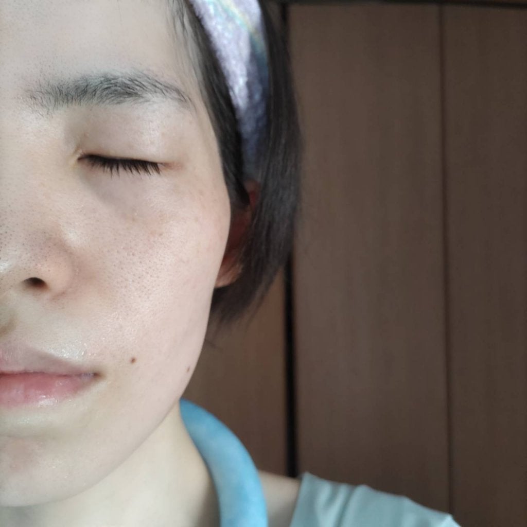 レッドブレミッシュ クリアスージングクリーム/Dr.G/フェイスクリームを使ったクチコミ(9枚目)