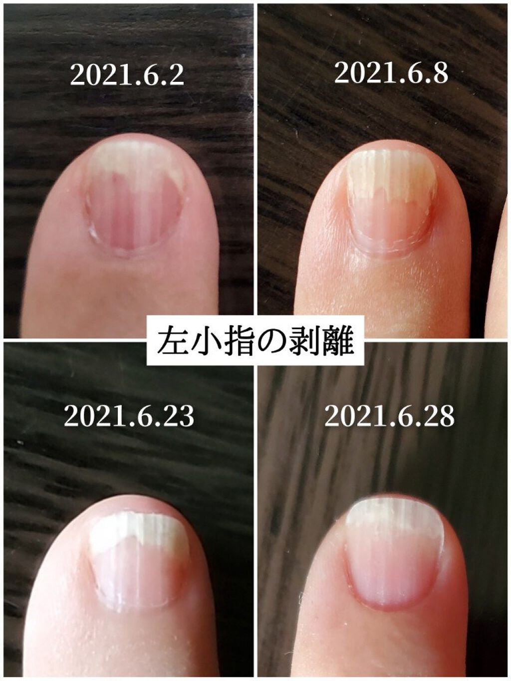 ネイルベッドオイル/アンドネイル/ネイルオイル・トリートメントを使ったクチコミ(5枚目)