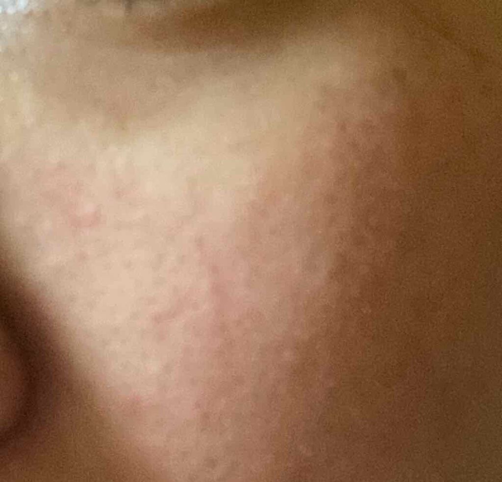 ハトムギ化粧水(ナチュリエ スキンコンディショナー R )/ナチュリエ/化粧水を使ったクチコミ（2枚目）