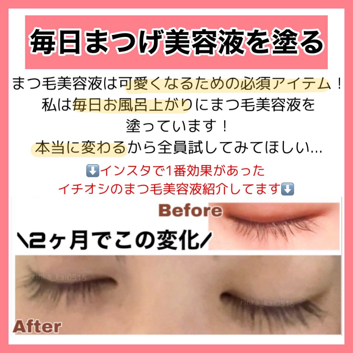 お米のマスク/毛穴撫子/シートマスク・パックを使ったクチコミ(4枚目)