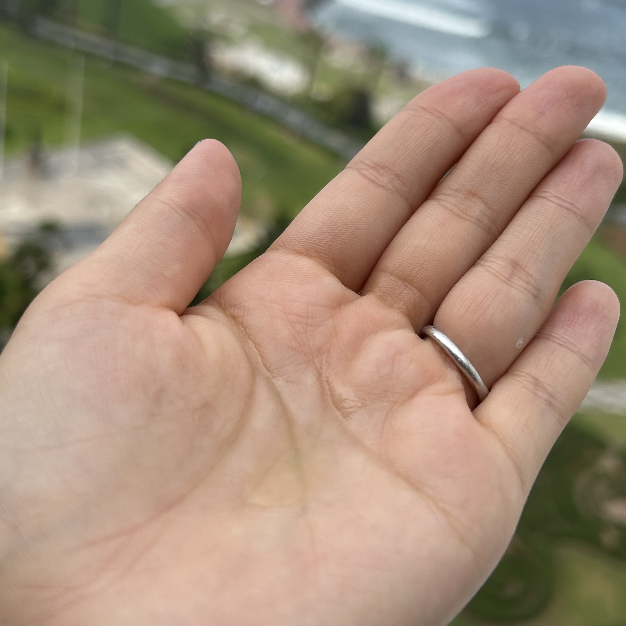 AHA·BHA·PHA 30デイズミラクルセラム/SOME BY MI/美容液を使ったクチコミ（2枚目）