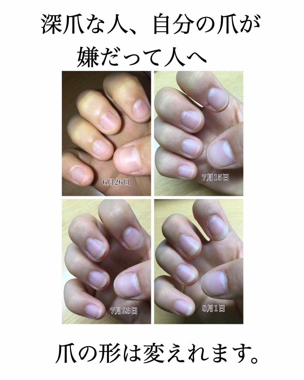 AC キューティクルオイル/AC MAKEUP/ネイルオイル・トリートメントを使ったクチコミ（1枚目）