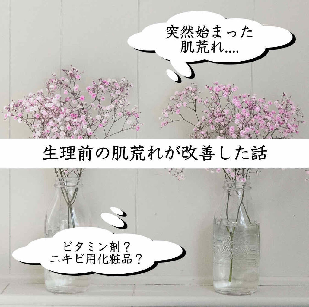 アポスティークリーム(医薬品)/アポスティー/その他を使ったクチコミ（1枚目）