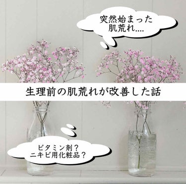 アポスティー アポスティークリーム(医薬品)のクチコミ「〻〻 生理前の肌荒れが改善した話 〻〻


高校生・専門学生の頃は 肌荒れが全くなく
思春期ニ.....」（1枚目）