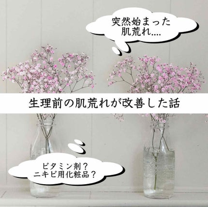 アポスティークリーム(医薬品)/アポスティー/その他を使ったクチコミ(1枚目)