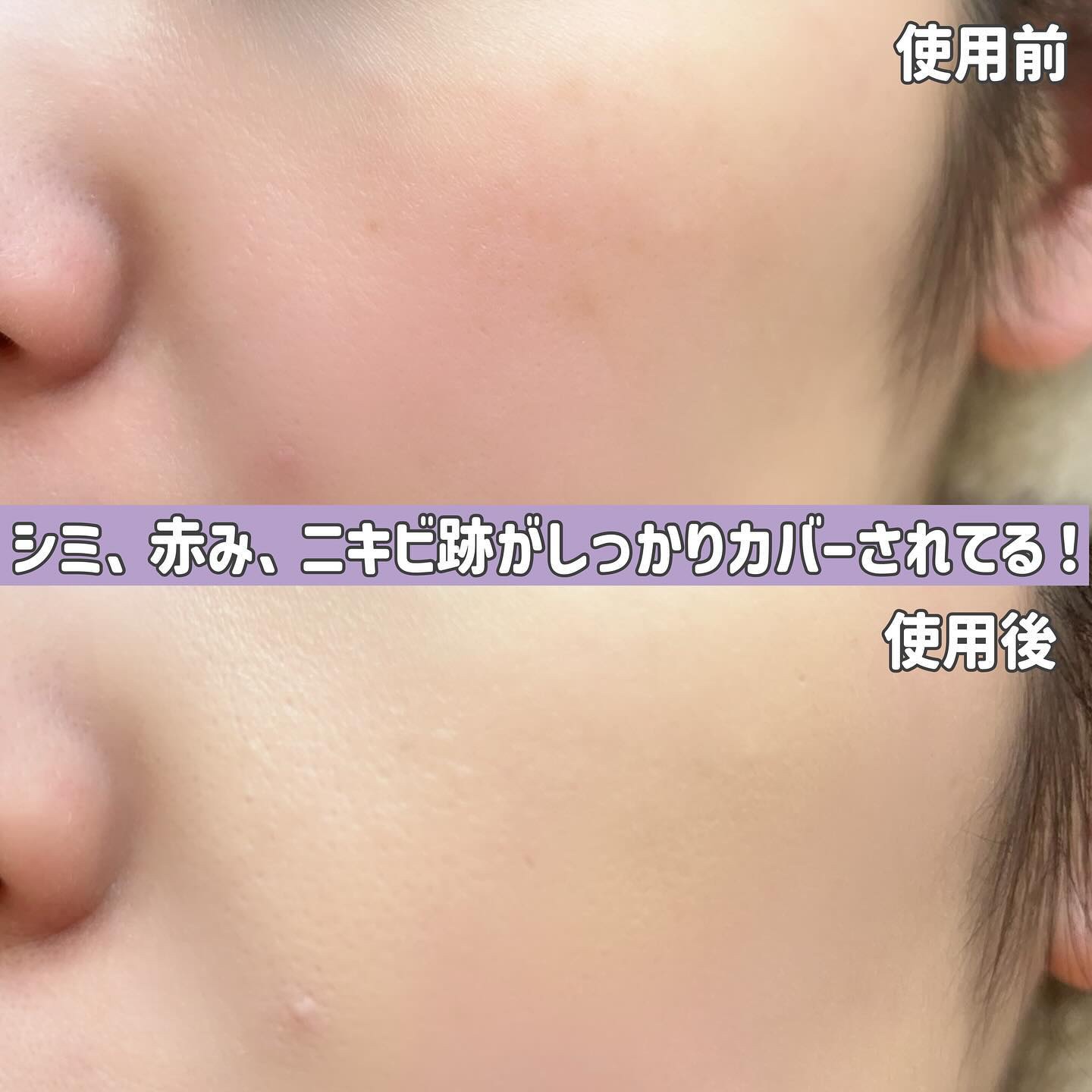 アイドルカバーコンシーラー/TFIT/リキッドコンシーラーを使ったクチコミ（3枚目）