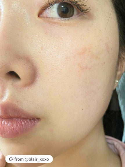 プロテーラービーグロウクッション ニュークラス/espoir/クッションファンデーションを使ったクチコミ(2枚目)