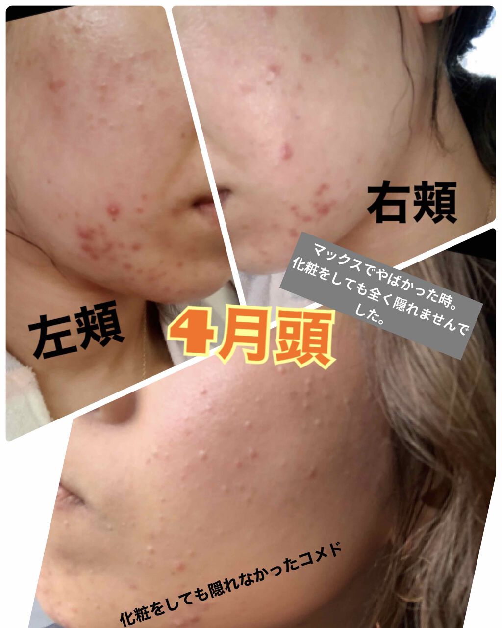 ボラージ クリーム/ちふれ/ボディクリームを使ったクチコミ（2枚目）