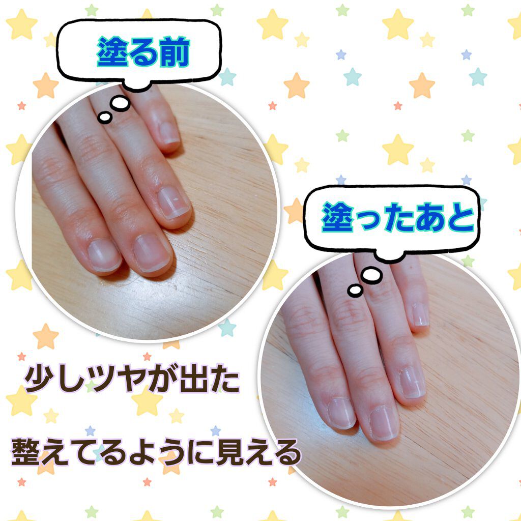 ディーアップファンデーション/D-UP/ネイルベースコートを使ったクチコミ（2枚目）