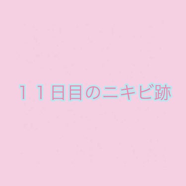 敏感肌用薬用美白美容液/無印良品/美容液を使ったクチコミ（1枚目）