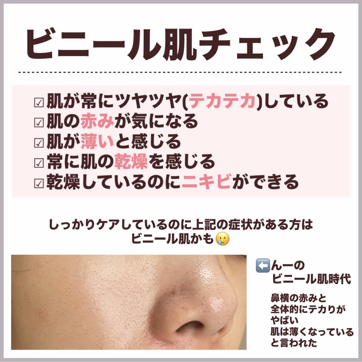 エファクラ ピールケア セラム/ラ ロッシュ ポゼ/美容液を使ったクチコミ（3枚目）