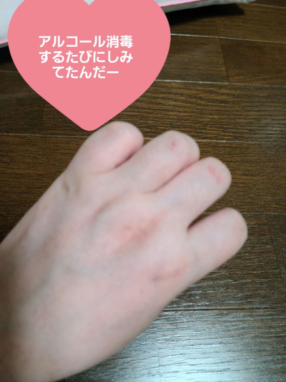 ヒルマイルドクリーム(医薬品)/健栄製薬/その他を使ったクチコミ(3枚目)