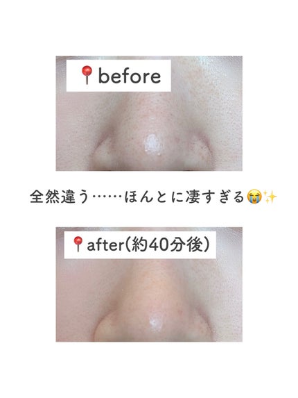 ナチュラルマイルドクリアノーズパック/ilso/シートマスク・パックを使ったクチコミ(3枚目)