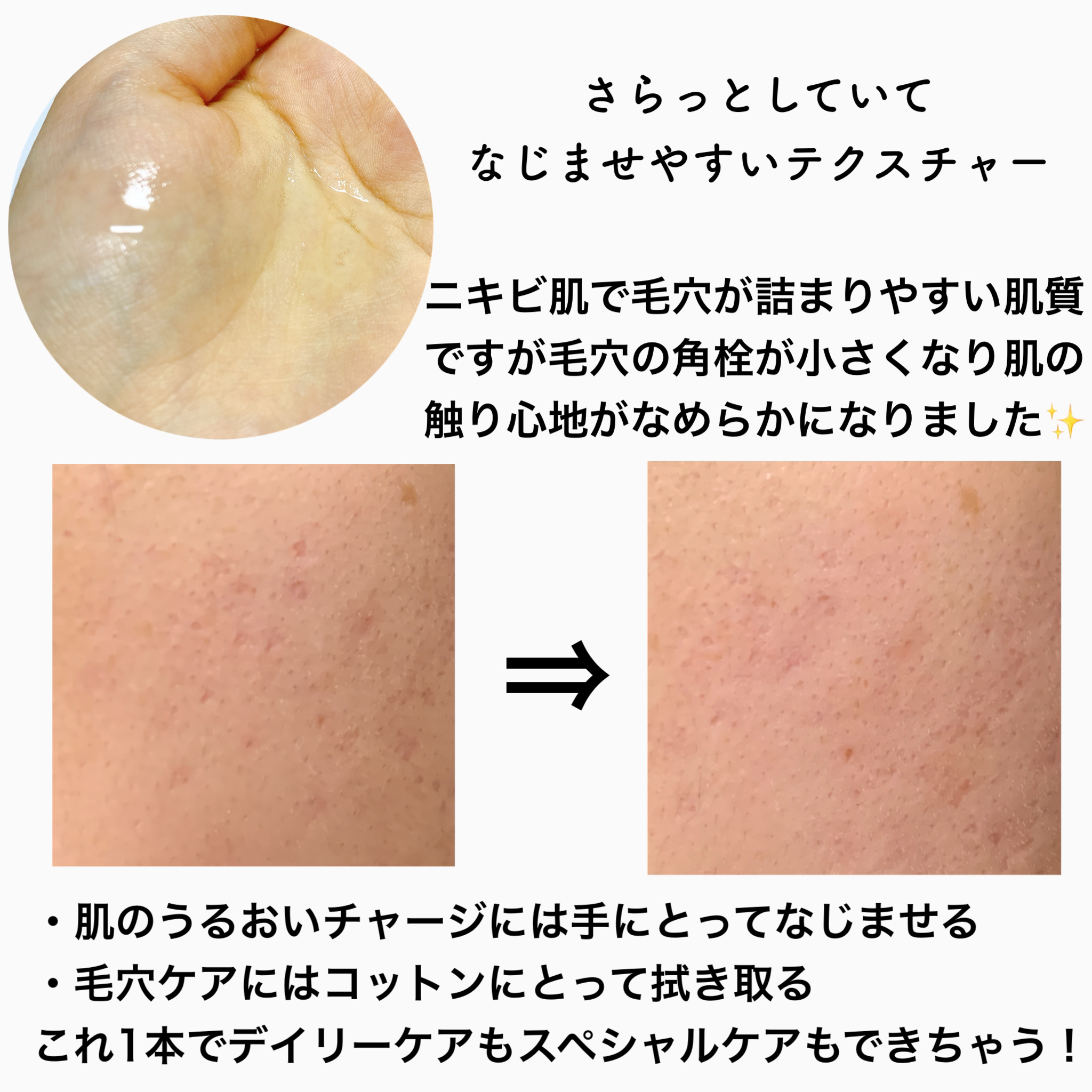 サミュ ガラクトポア オーツートナー/SAM'U/化粧水を使ったクチコミ（3枚目）