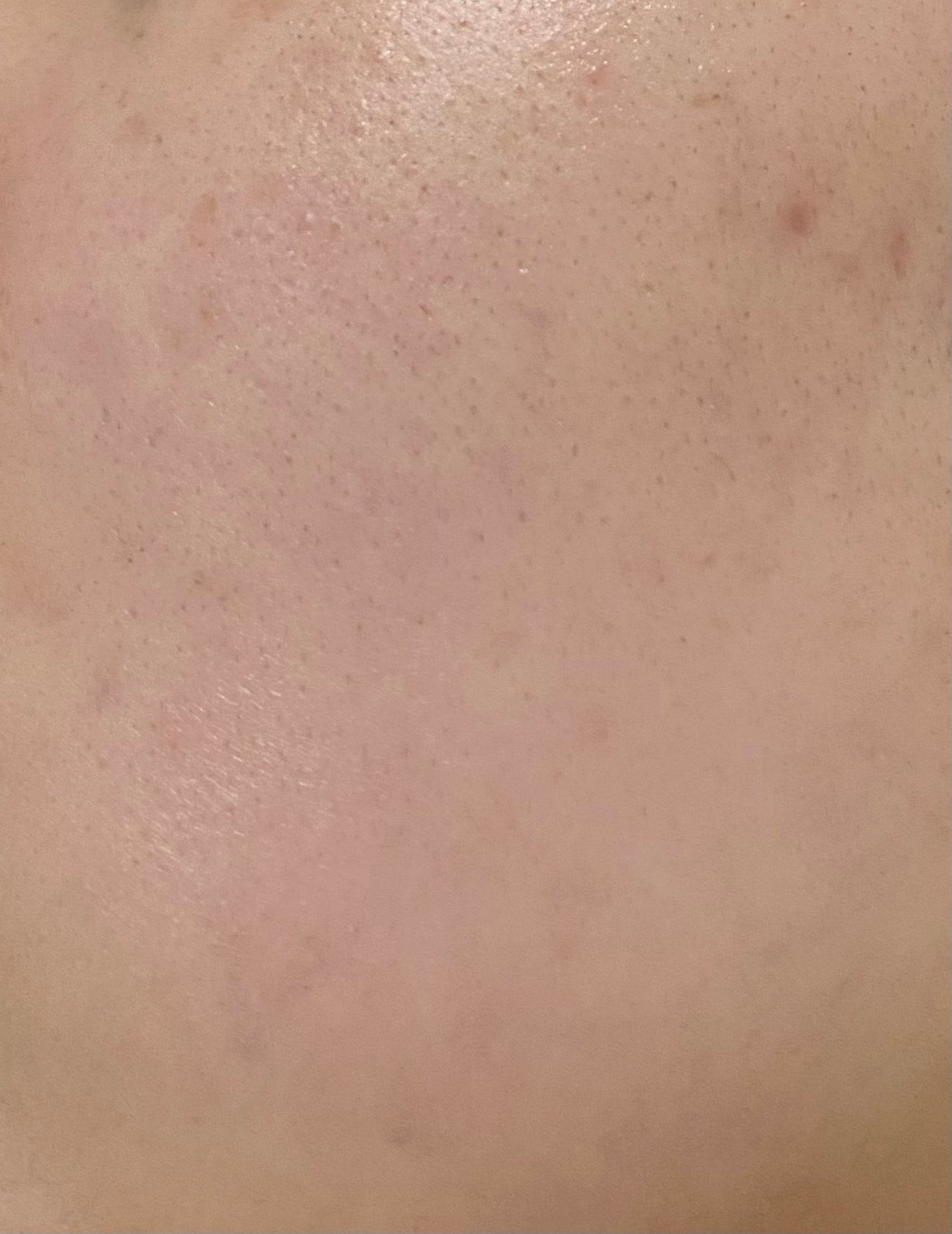 ãã on LIPS ãðè芳å¯ðãã©ã¯ã·ã§ãã«ã¬ãŒã¶ãŒã®ããŠã³ã¿ã€ã ãå®å
šã«çµãã£ã..ãïŒ2æç®ïŒ