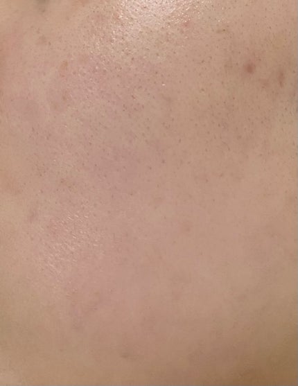 ãã on LIPS ãðè芳å¯ðãã©ã¯ã·ã§ãã«ã¬ãŒã¶ãŒã®ããŠã³ã¿ã€ã ãå®å
šã«çµãã£ã..ãïŒ2æç®ïŒ