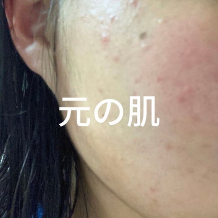 薬用しみ集中対策 プレミアム美容液/メラノCC/美容液を使ったクチコミ(3枚目)