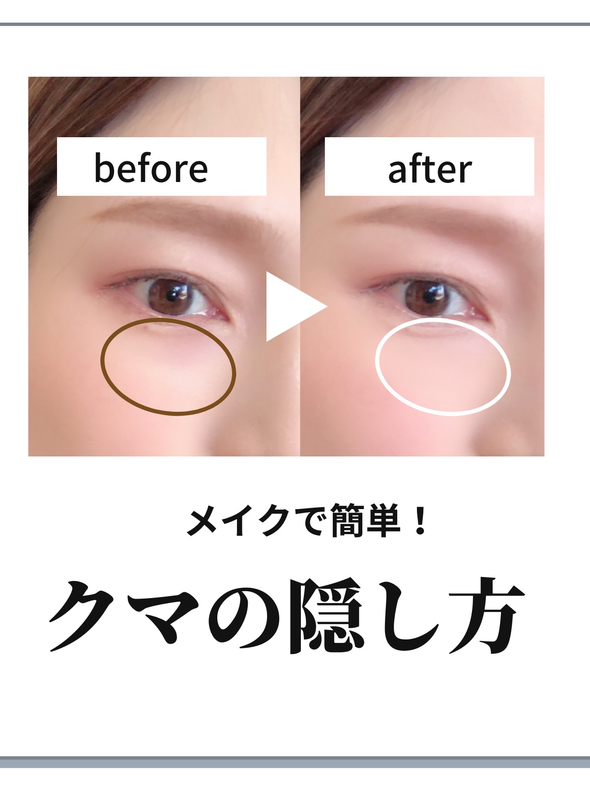 フローレス フュージョン ウルトラ ロングウェア コンシーラー/ローラ メルシエ/リキッドコンシーラーを使ったクチコミ（1枚目）