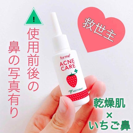 イチゴ鼻薬用はがさないパック【医薬部外品】/フォーミィ/洗い流すパック・マスクを使ったクチコミ(1枚目)