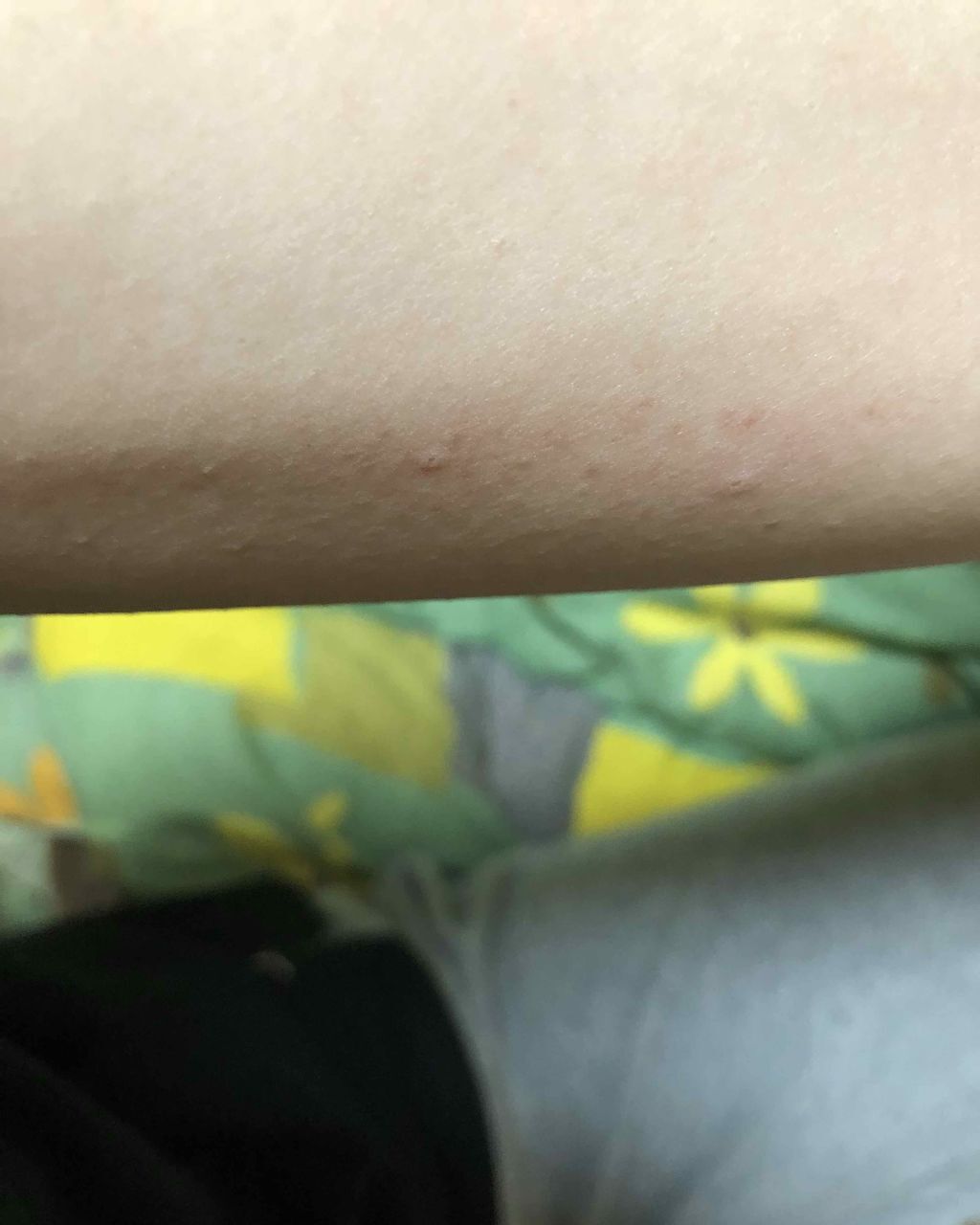 ウサみぃ on LIPS 「緊急追記です💦2枚目から閲覧注意ですので、文章内容から見ても大..」(4枚目)