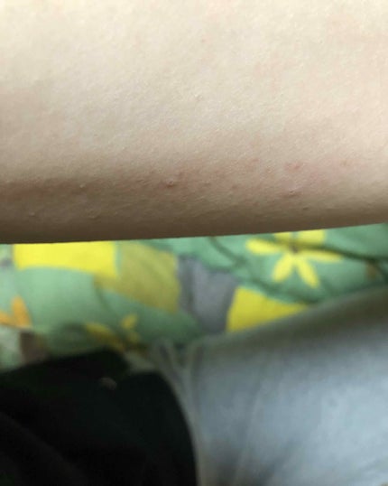 ウサみぃ on LIPS 「緊急追記です💦2枚目から閲覧注意ですので、文章内容から見ても大..」(4枚目)