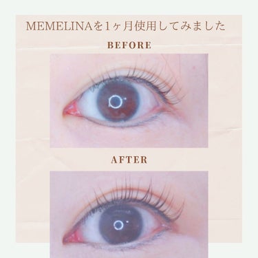 MEMELINA eyelash serum/MEMELINA/まつげ美容液を使ったクチコミ（3枚目）