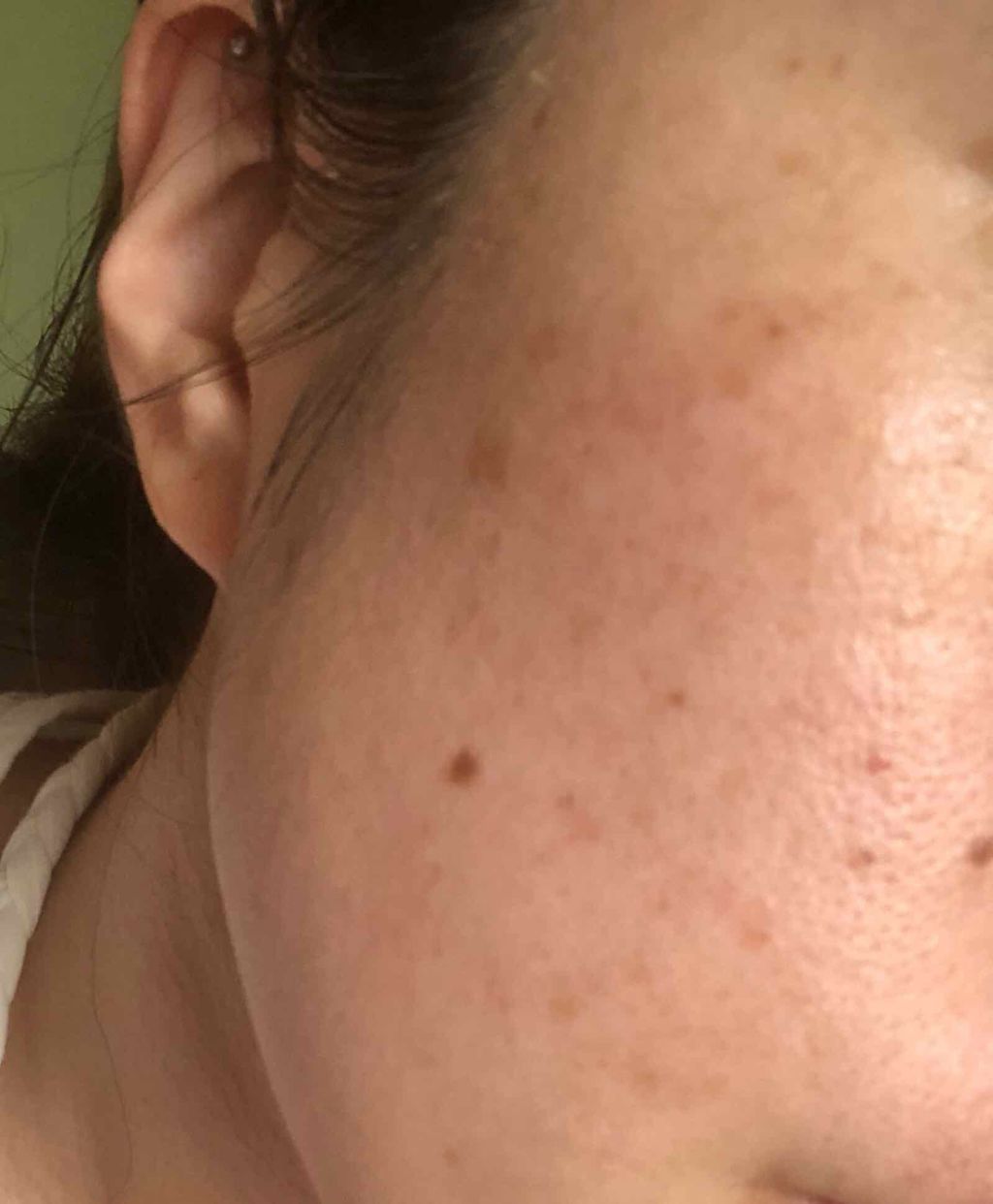 水光ケア フェイシャルマスク(プラセンタ)/MITOMO/シートマスク・パックを使ったクチコミ（2枚目）