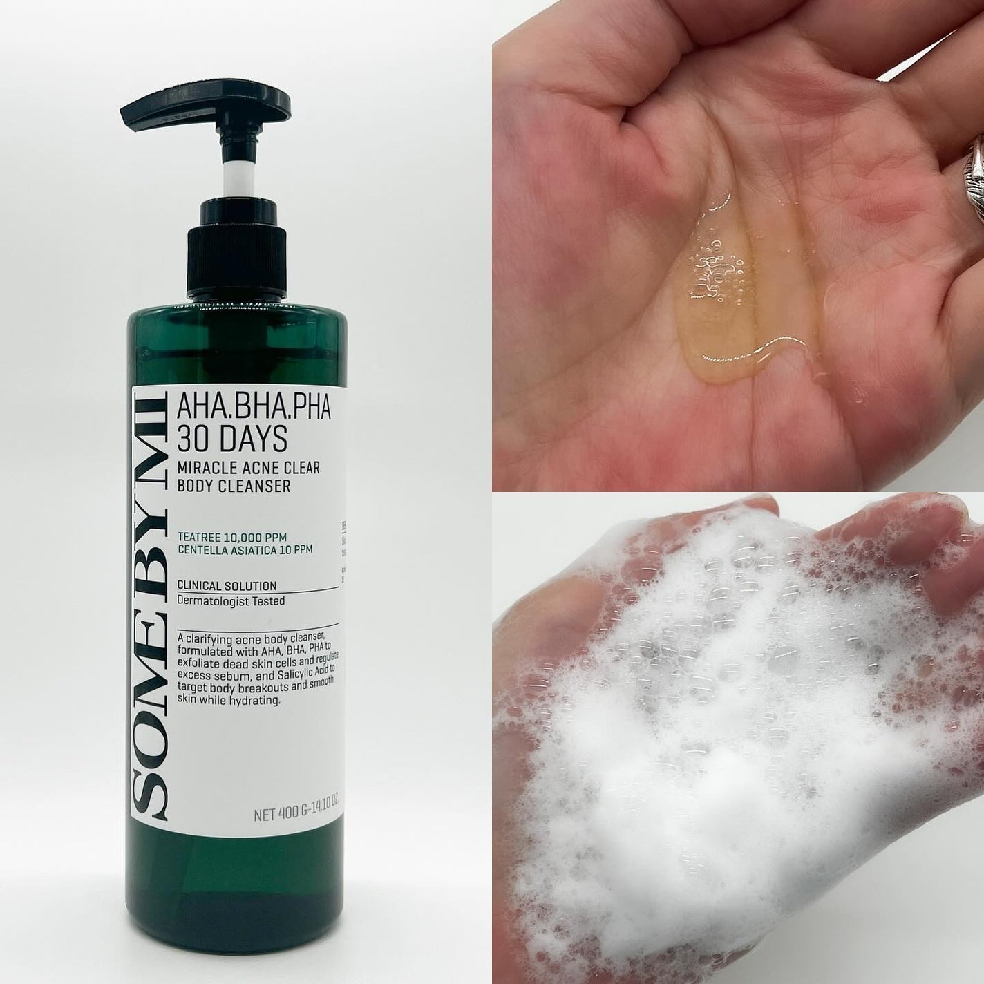 AHA·BHA·PHA 30デイズミラクルアクネボディクレンザー/SOME BY MI/ボディソープを使ったクチコミ(2枚目)